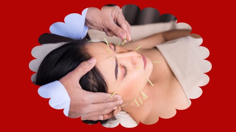 Acupuncture - shaadicounselling.com Acupuncture